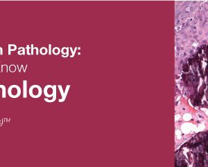 Classic Lectures in Pathology What You Need to Know Breast Pathology 2019