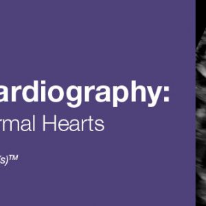 2020 Fetal Echocardiography: Normal and Abnormal Hearts