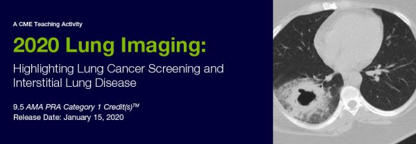 2020 Lung Imaging: Highlighting Lung Screening and Interstitial Lung Disease