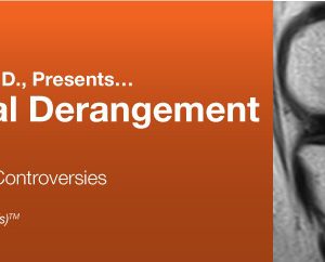 2018 Internal Derangement of Joints: Current Concepts and Controversies