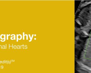2019 Fetal Echocardiography: Normal and Abnormal Hearts