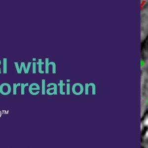 2020 Updates in Prostate MRI with Pathology Correlation