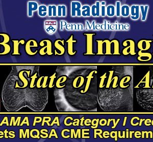 Penn Radiology Breast Imaging: State of the Art 2018