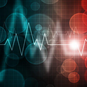 Mayo Clinic Practical ECG Pearls – ECG Rhythm Update 2020