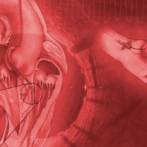 Mayo Clinic Interventional Cardiology Online Board Review 2020