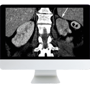 Abdominal and Thoracic Imaging Guidelines Applied: Evidence Versus Opinion 2021