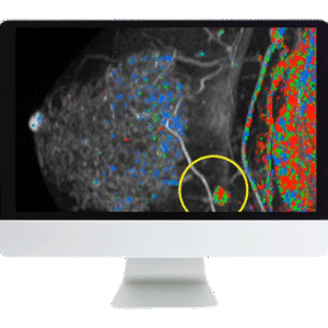 Breast Imaging Pearls and Pitfalls: Traditional and Novel Imaging Approaches 2020