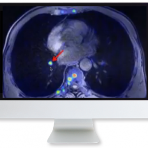 Applying Recent Advances in PET to Clinical Practice 2020