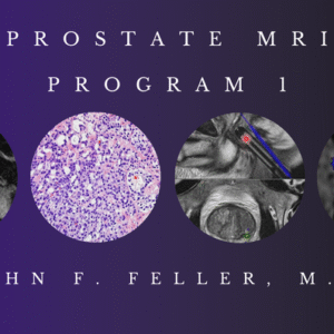 CME Science : Prostate MRI (Program 1) 2021