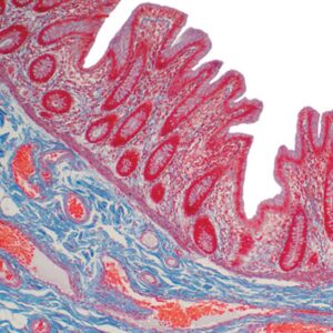 Current Topics in Gastrointestinal and Liver Pathology 2022