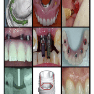 gIDEdental A-Z in Restorative Implant Dentistry