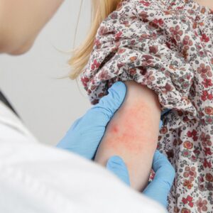 Dermatology for Primary Care 2022