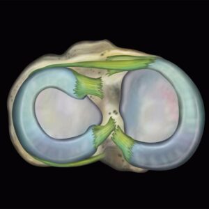 MRIOnline MRI Mastery Series: Knee 2021