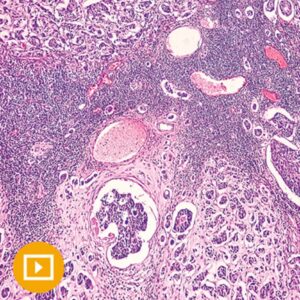 Masters of Pathology : Breast Pathology 2023