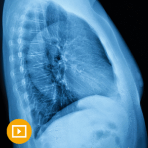 UCSF Thoracic Imaging 2023