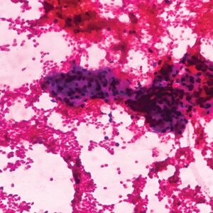 Harvard Advances in Cytology and Small Biopsies 2023