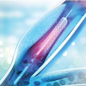 Comprehensive Review and Update of What’s New in Vascular and Endovascular Surgery 2023