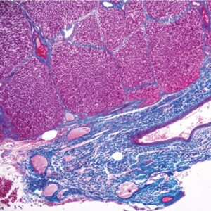 Current Topics in Gastrointestinal and Liver Pathology 2023