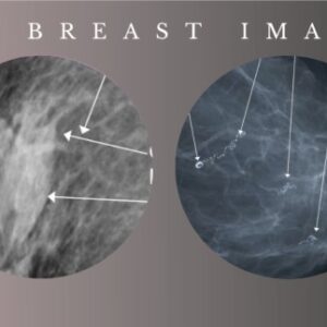 Advanced Breast Imaging 2024 – CMEScience