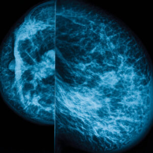 UCSF Breast Imaging 2024