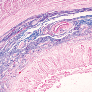 Masters of Pathology : Gastropathology 2024