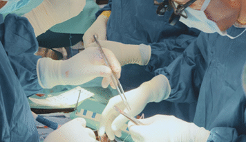 Comprehensive Review of Cardiac Surgery 2025
